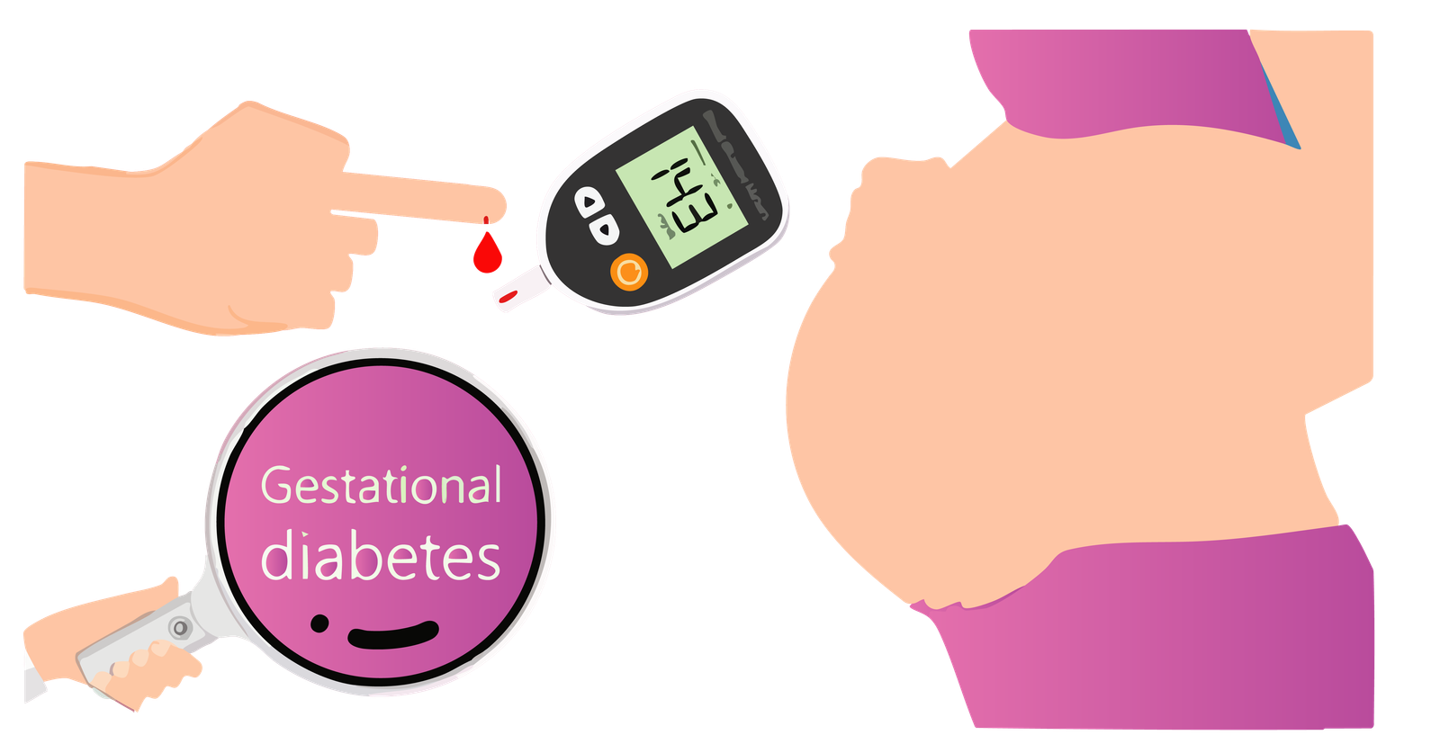 gestational diabetes treatment